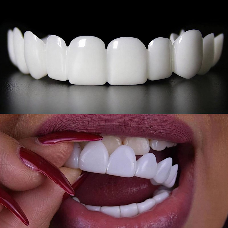 لمینت دندان دو فک مدل Snap on Smile